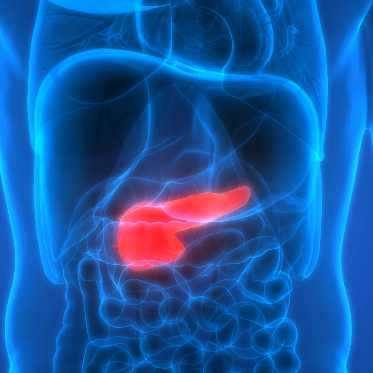 Pancreatic Cancer